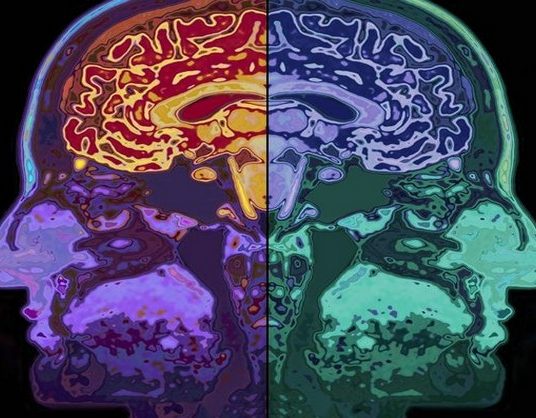 Další výzkum potvrdil změny ve struktuře a výkonu mozku meditujících lidí
